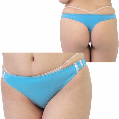 �Q�������X�g���b�`�u���}�s�o�b�N�@�^�[�R�C�Y�i�����W�F���[�j